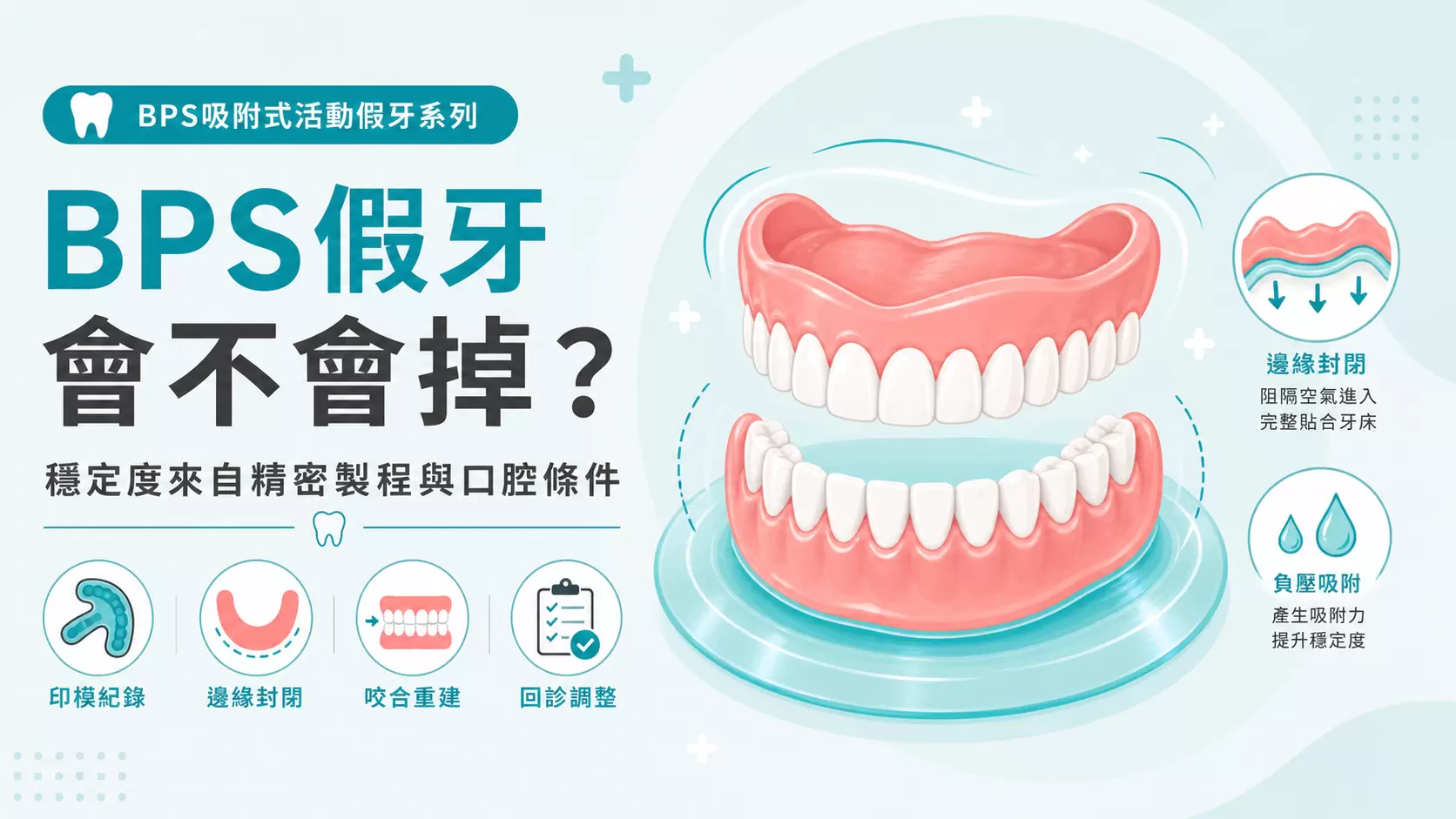 BPS吸附式活動假牙會不會掉?穩定度、製程差異與適合族群完整說明 BPS吸附式活動假牙穩定度與上下顎全口假牙密合示意