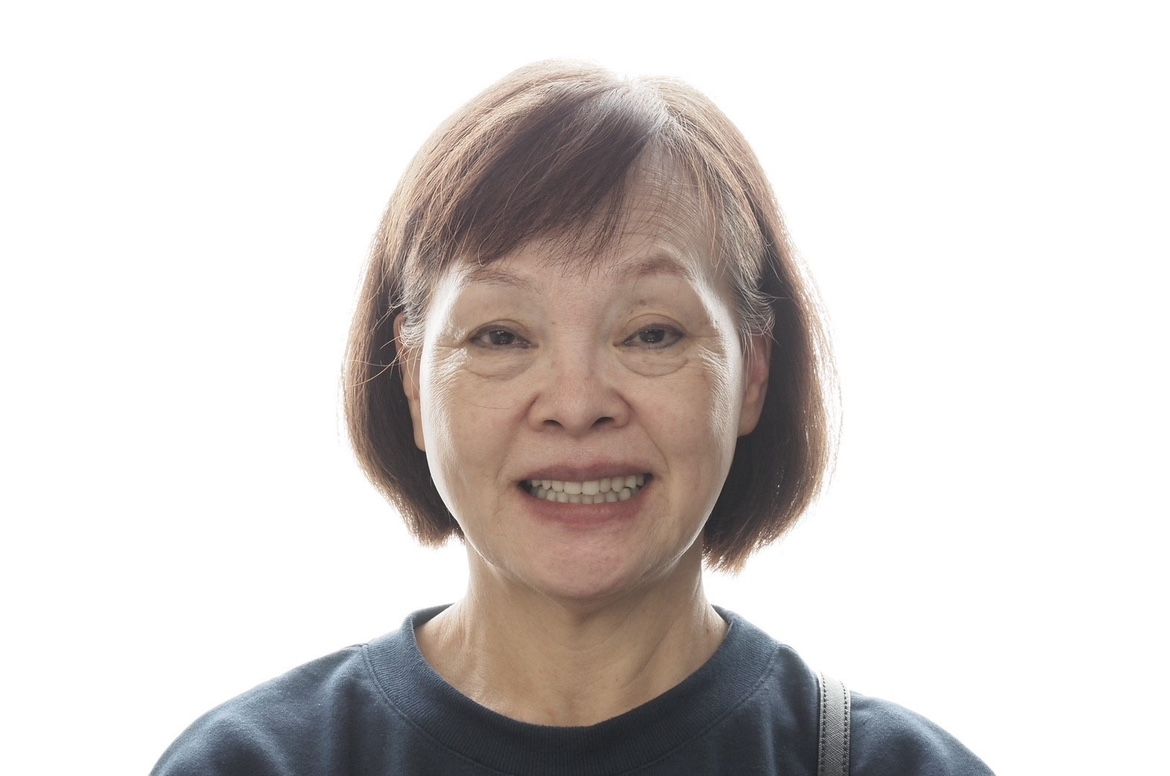 日本BPS活動假牙 配戴體驗分享 【三井牙科集團】最好的母親節禮物~奕妏媽媽分享~