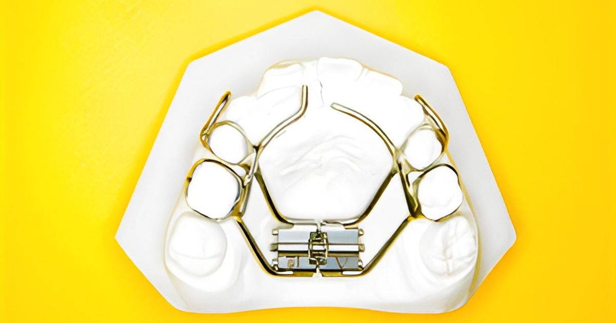 【牙醫師來解答】孩子適合哪種矯正器?固定式v.s.活動式差異大解析!(feat.波音牙醫診所 王子欣醫師) 【牙醫師來解答】孩子適合哪種矯正器?固定式v.s.活動式差異大解析!(feat.波音牙醫診所 王子欣醫師)