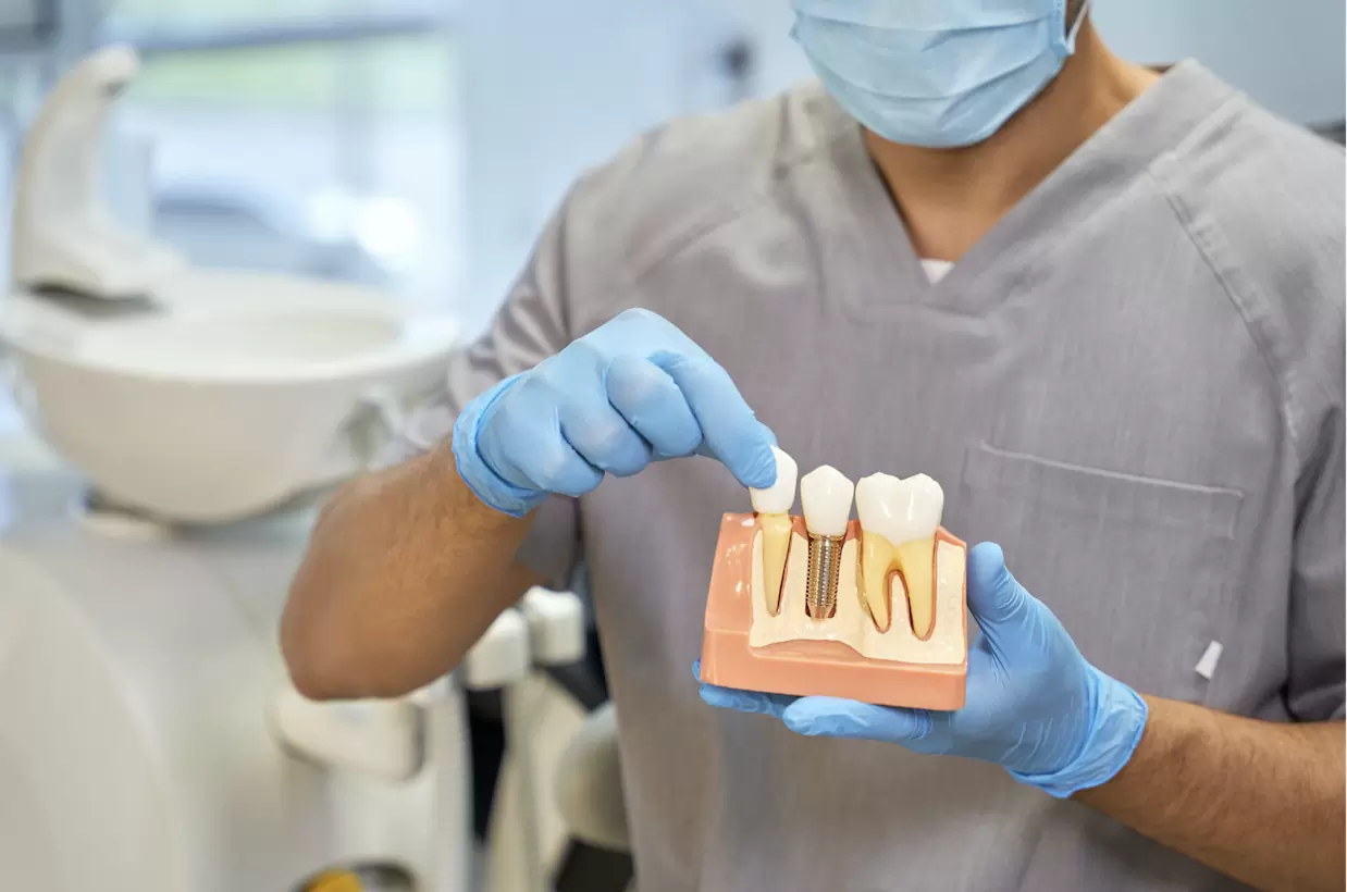 為什麼有些植體這麼便宜？(Feat.巨蛋三井 陳宜廷醫師)