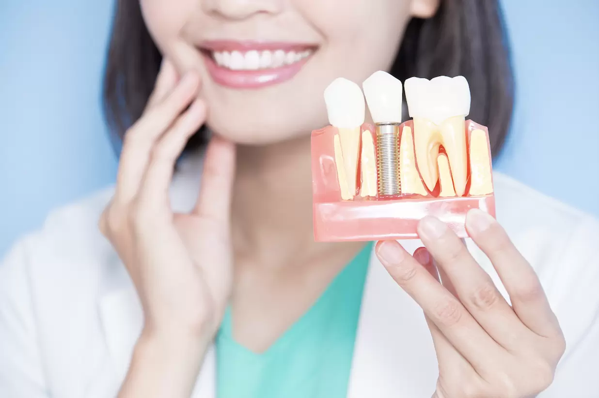 🦷 植體保固有陷阱？大廠、小廠差在哪？一篇帶你看懂！(Feat.林口三井 楊倚弦醫師)