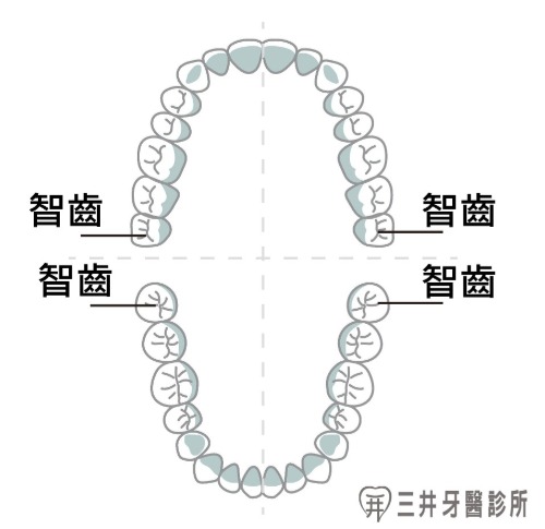跟智齒說掰掰 跟智齒說掰掰