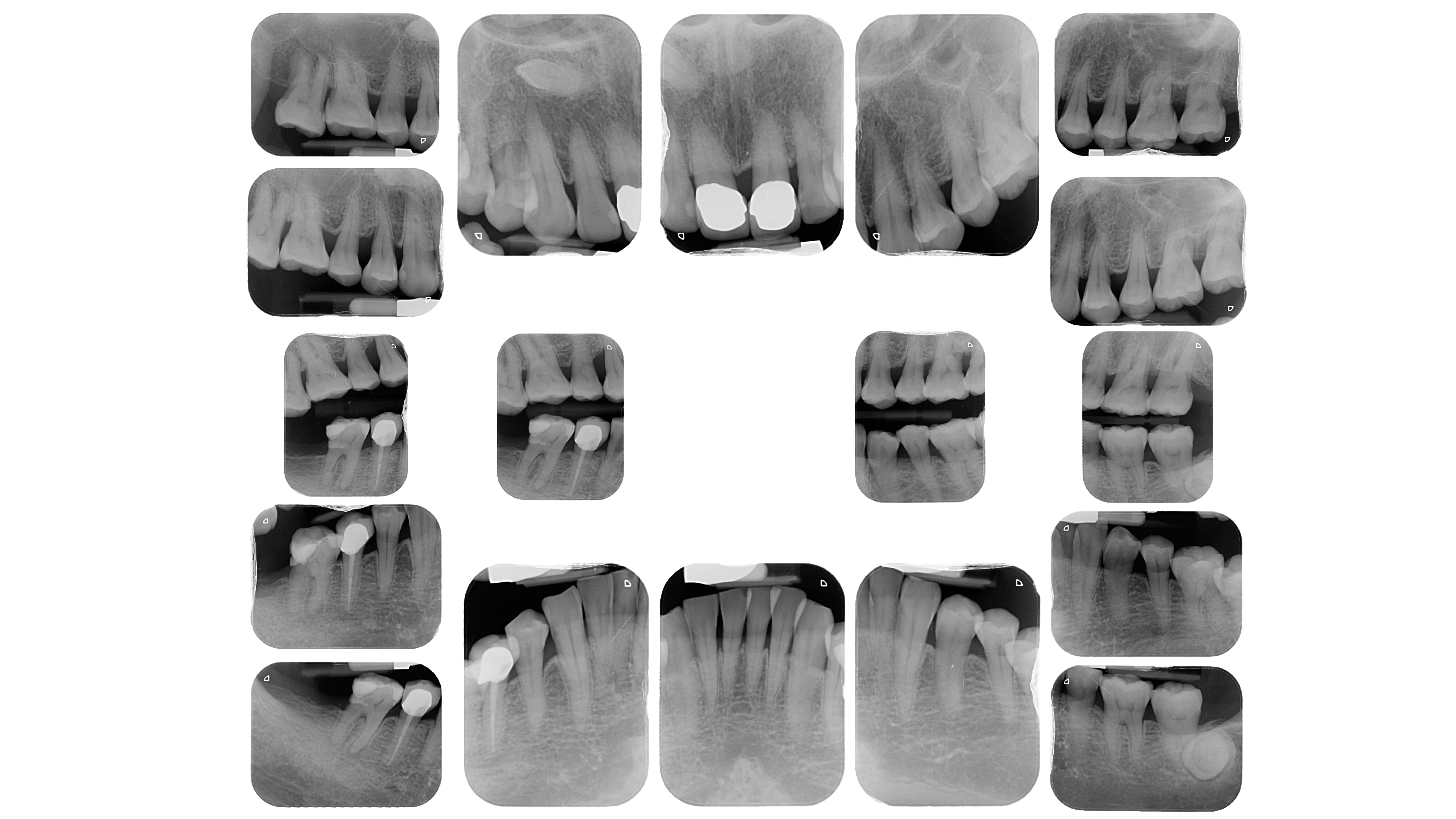 【牙醫師來解答】看懂牙周療程123,讓牙周病不再找麻煩!(feat.三井牙醫診所 何昱璇醫師) 【牙醫師來解答】看懂牙周療程123,讓牙周病不再找麻煩!(feat.三井牙醫診所 何昱璇醫師)